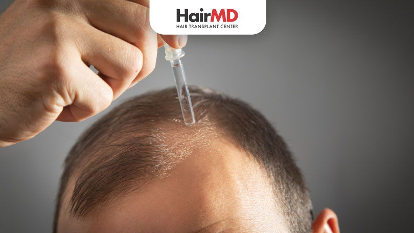 क्या-Finasteride-से-Hair-Fall-रुक-जायेंगे Topical Finasteride