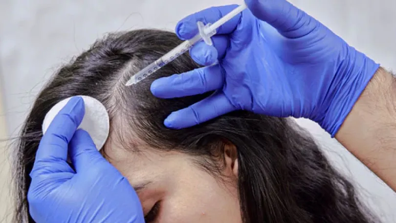 Exosomes-for-Hair-Growth exosomes for hair Growth