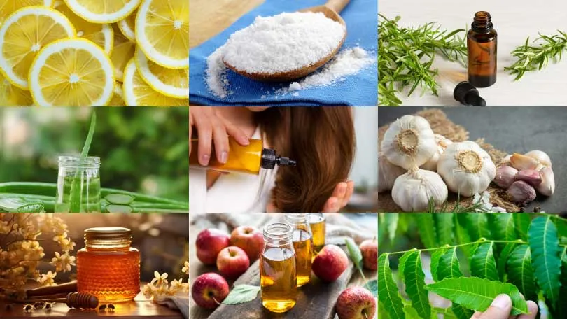 Home Remedies to Get Rid of Dandruff Quickly and Naturally Home Remedies to Get Rid of Dandruff Quickly and Naturally