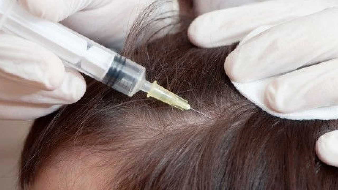 Intralesional-Steroid-Injections Intralesional Steroid Injections