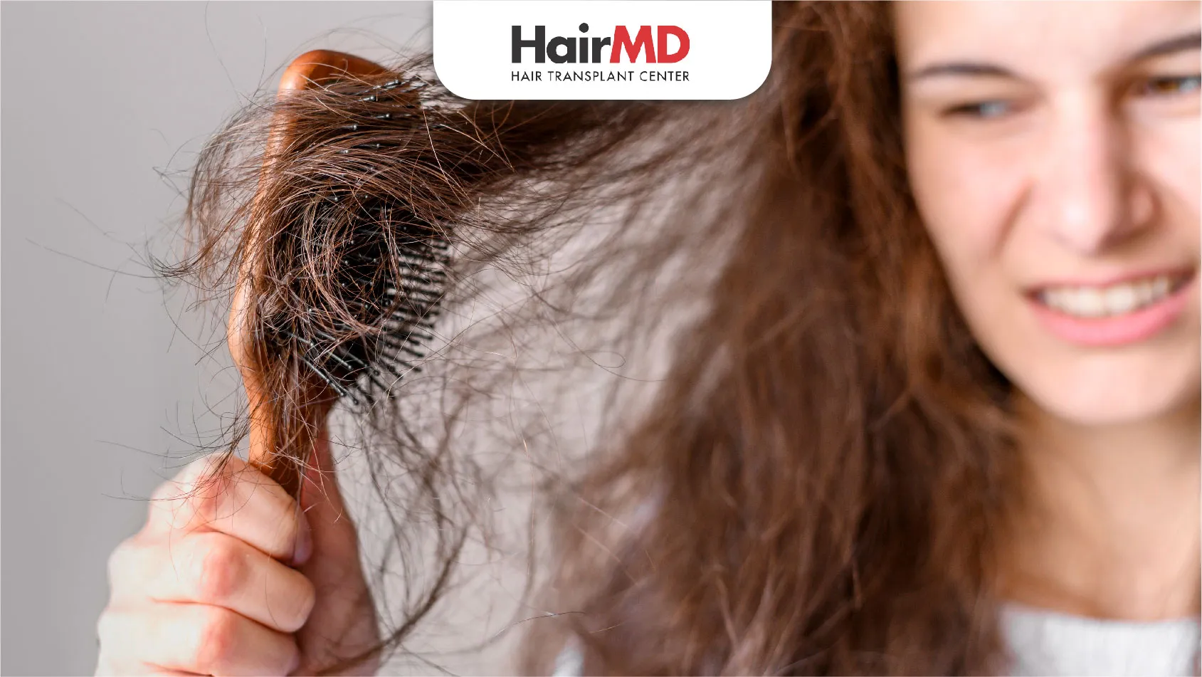 Top causes of hair loss in women Top causes of hair loss in women