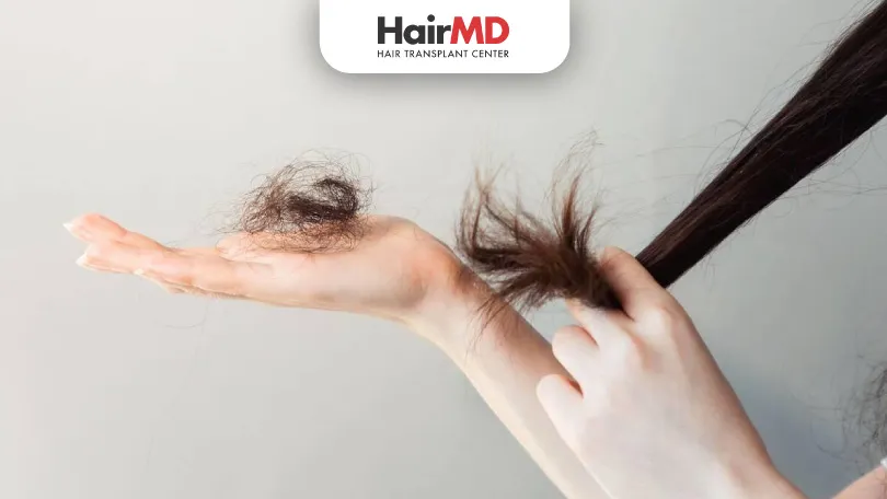 Trichotillomania-Causes,-Symptoms-&-Treatment-for-Hair-Pulling-Disorder Trichotillomania-Causes,-Symptoms-&-Treatment-for-Hair-Pulling-Disorder